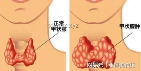 **每一次怒气，都是对甲状腺的隐形伤害💔**